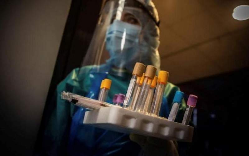 اسبانيا: حصيلة وفيات كورونا اليومية 301