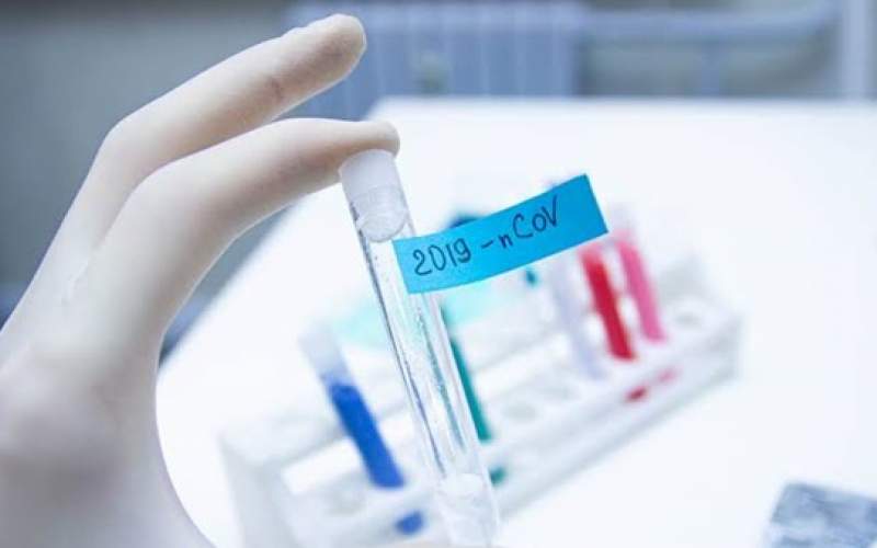 إيران وروسيا تناقشان إنتاج لقاح مشترك