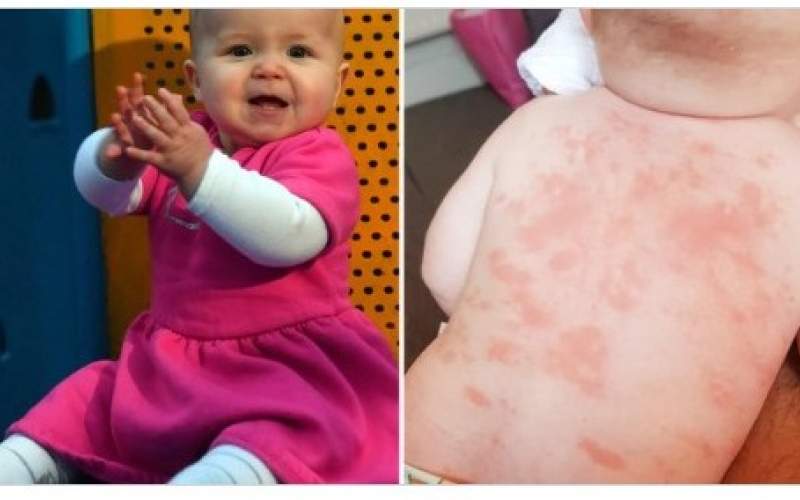 آثار جانبية جديدة لفيروس كورونا على الأطفال