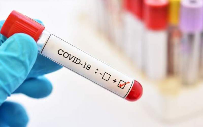 المجلس العلمي الفرنسي: الموجة الثالثة للوباء لا مفر منها خلال نهاية الشتاء او الربيع 2021