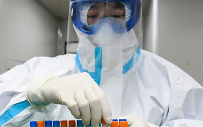 جهاز روسي يكشف فيروس كورونا بشكل فوري