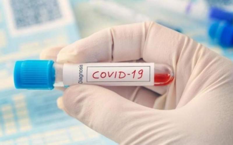 بـ 5 دولارات فقط.. قرار جديد بشأن فحص كورونا السريع 