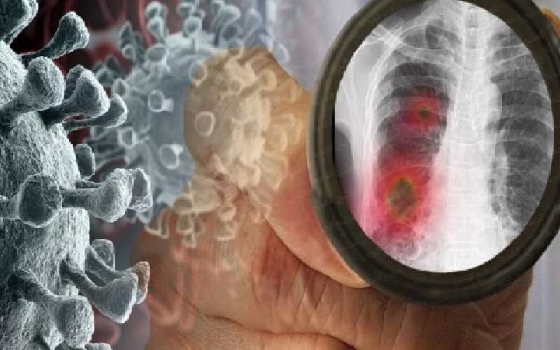 إصابات كورونا في الخليج تتخطى الــ 60 ألف إصابة