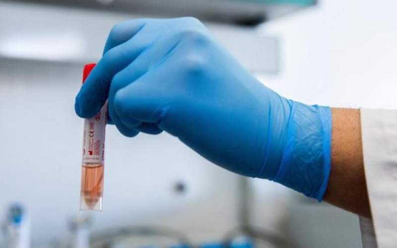 أميركا وفرنسا تختبران تجارب علاجية لمكافحة كورونا 