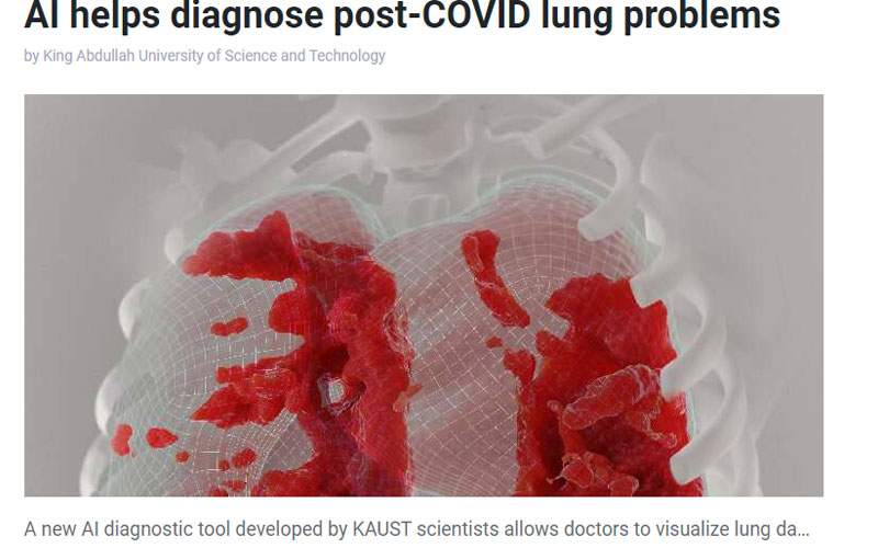 أداة تشخيصية جديدة  لمراقبة صحة الرئة بعد العدوى بفيروس كورونا
