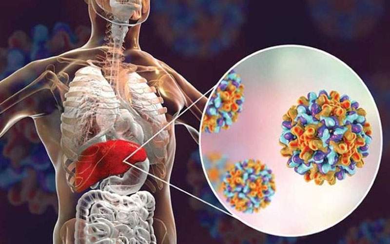 لبنان يسجل 1785 إصابة بمرض التهاب الكبد الفيروسي خلال 8 أشهر