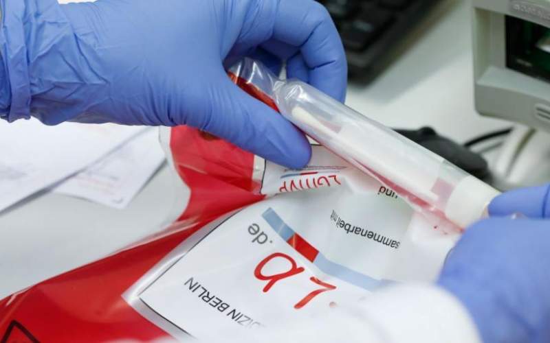 أكبر معهد للأمصال في العالم يعتزم صنع ملايين الجرعات من لقاح محتمل ضد كورونا