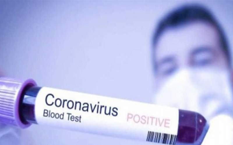  5218 إصابة و142 حالة وفاة جديدة بكورونا سجيلت في روسيا