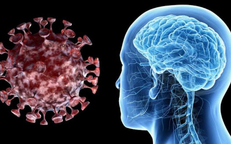 احذروا: كوفيد-19 قد يسبب سكتات دماغية بين الشباب والأصحاء وحتى دون أعراض!