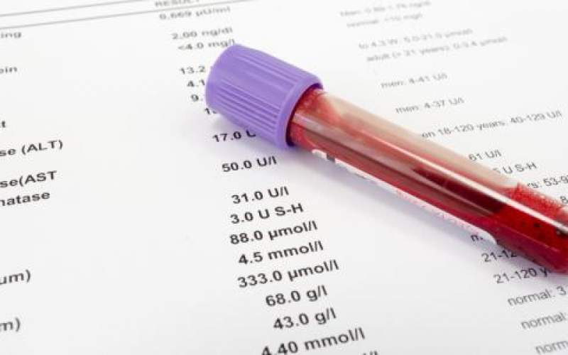 فحص الدم وعدوى كورونا.. دراسة تكشف مفاجأة