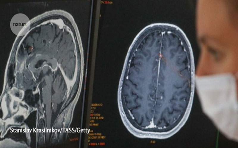 كيف يؤثر مرض كوفيد على الدماغ؟