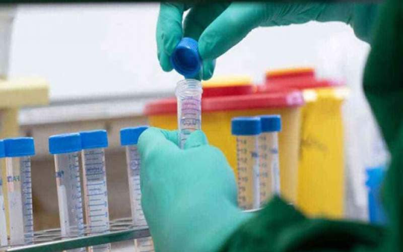 أمل جديد لصد الوباء.. عقار يمنع الإصابة بفيروس كورونا