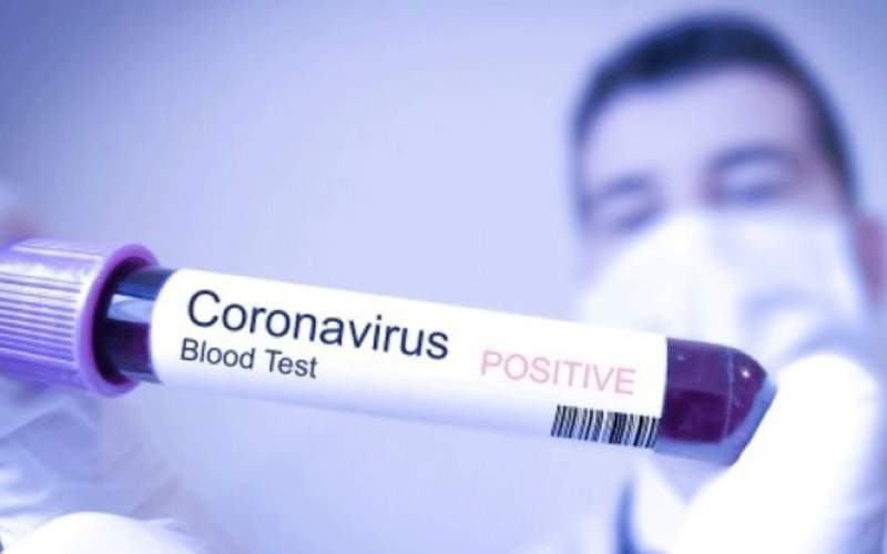 دراسة تتحدث عن مزايا الإصابة بكورونا 