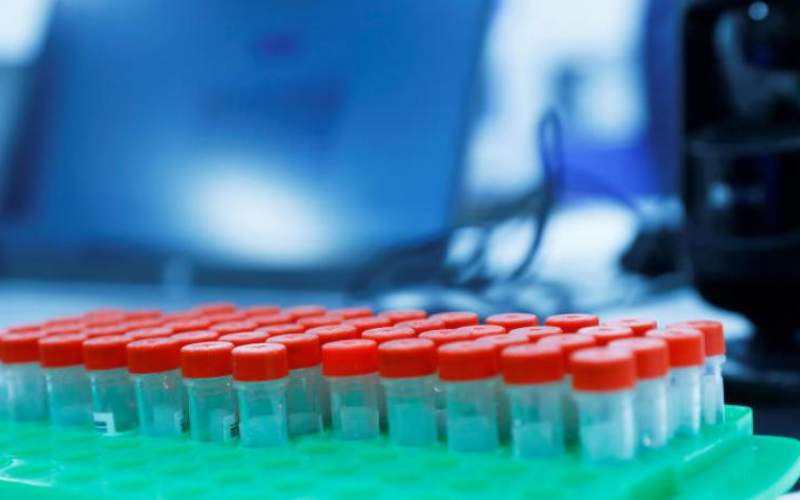 تطوير اختبار سريع لكورونا تظهر نتائجه بأقل من 5 دقائق