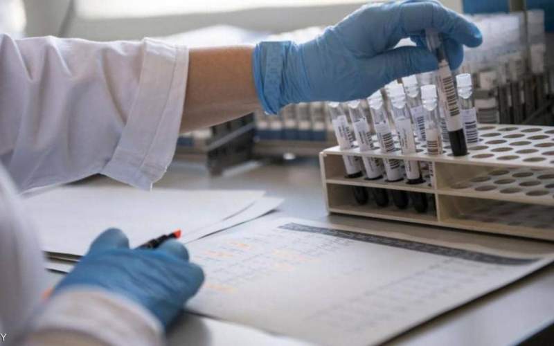 علماء يكشفون مضاعفات مقلقة لكورونا